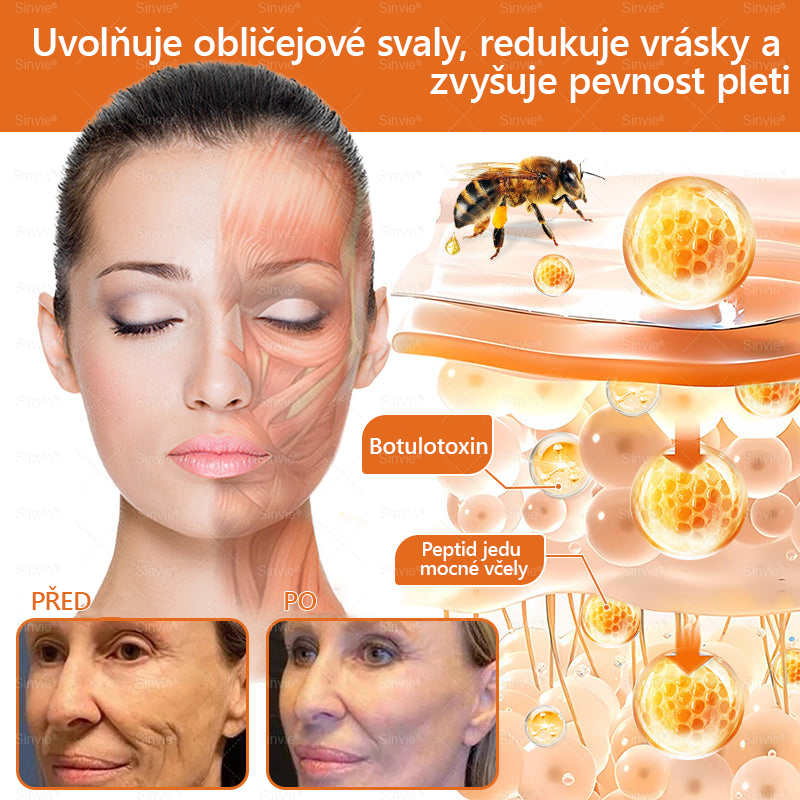 🐝 Sinvie® Krém na obnovu pleti s včelím jedem(👨⚕CE schváleno)👍✅