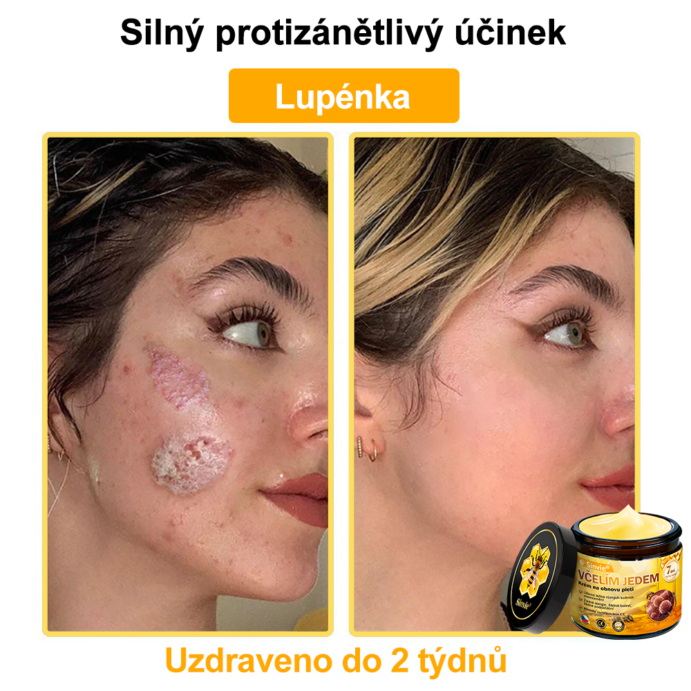 🐝 Sinvie® Krém na obnovu pleti s včelím jedem(👨⚕CE schváleno)👍✅