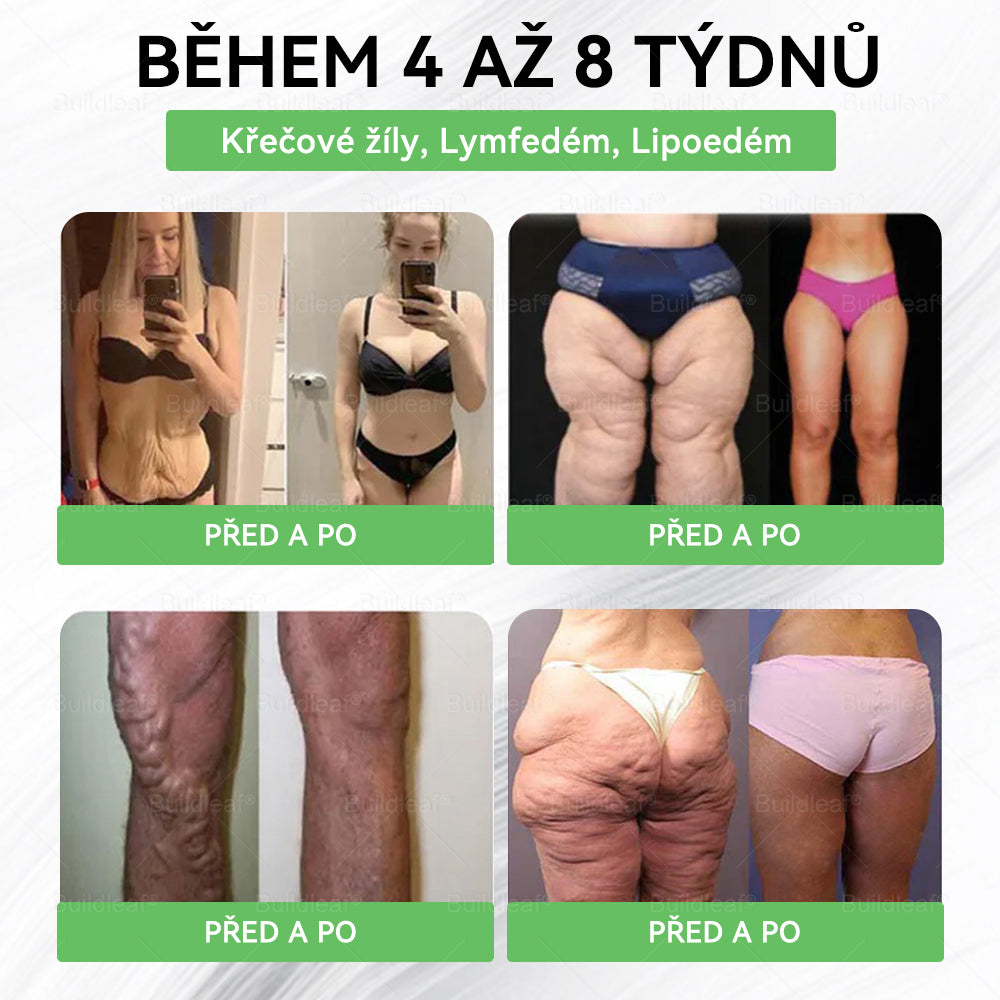 🍃Oficiální obchod ČR | BuildLeaf® GLP-1 8-v-1 Fit & Vital Řešení (Jednou denně, viditelné změny za 7 dní) ✅ Obezita, kardiovaskulární zdraví, cukrovka, spánková apnoe, zdraví střev, problémy se klouby a další.
