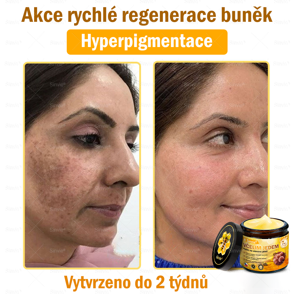 🐝 Sinvie® Krém na obnovu pleti s včelím jedem(👨⚕CE schváleno)👍✅