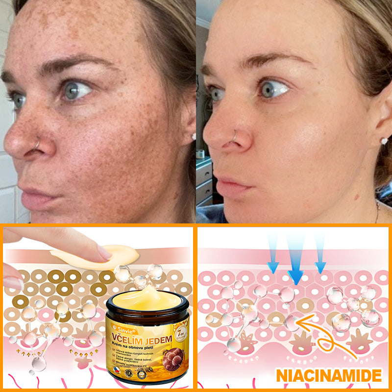 🐝 Sinvie® Krém na obnovu pleti s včelím jedem(👨⚕CE schváleno)👍✅
