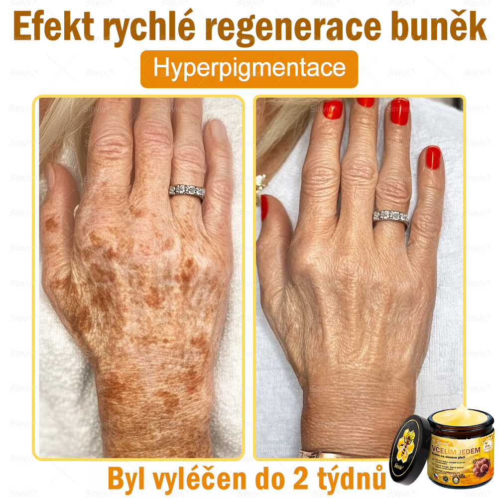 🎁 Zbývá už jen 5 krabiček. Nabízíme vám dodatečnou 70% slevu! Udržujte si zdravou postavu. Pokud to teď propásnete, příští rok už nebudete mít šanci.