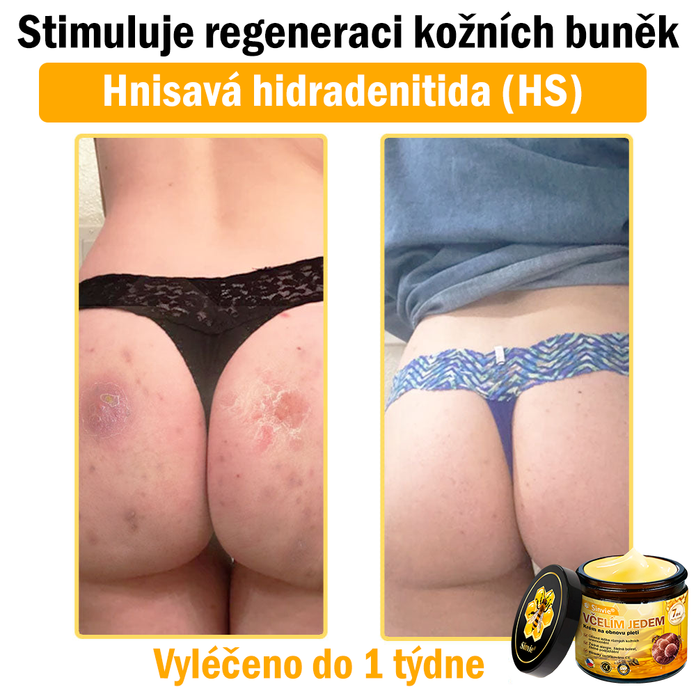 🎁 Zbývá už jen 5 krabiček. Nabízíme vám dodatečnou 70% slevu! Udržujte si zdravou postavu. Pokud to teď propásnete, příští rok už nebudete mít šanci.